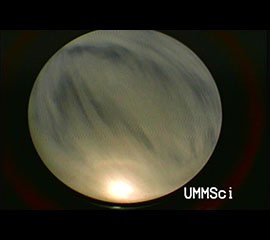 When the Sun and Moon Are Not the Only Circles in the Sky